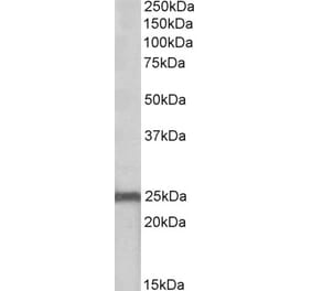 Western Blot - Anti-NDUFS8 Antibody (A84843) - Antibodies.com