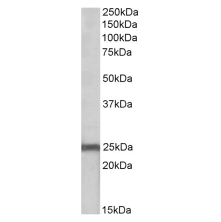 Western Blot - Anti-NDUFS8 Antibody (A84843) - Antibodies.com