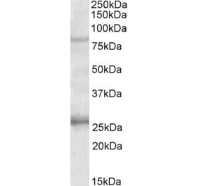 Western Blot - Anti-GPRIN3 Antibody (A84846) - Antibodies.com