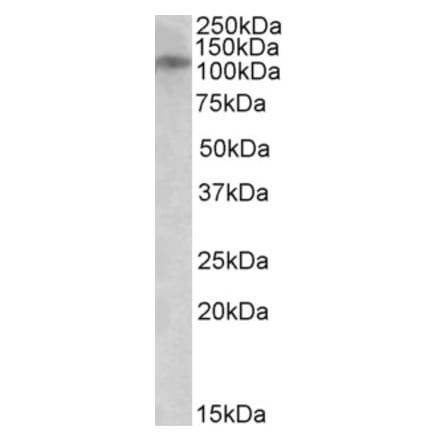 Western Blot - Anti-NR3B Antibody (A84847) - Antibodies.com