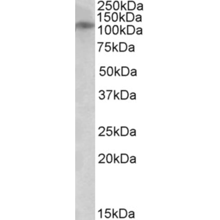 Western Blot - Anti-NR3B Antibody (A84847) - Antibodies.com