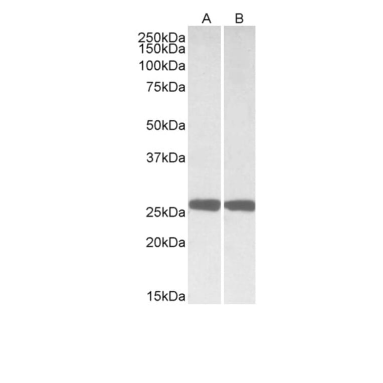 Western Blot - Anti-PGP9.5 Antibody (A84848) - Antibodies.com