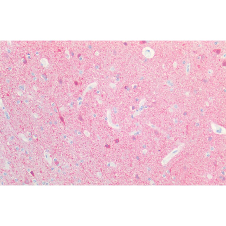 Immunohistochemistry - Anti-PGP9.5 Antibody (A84848) - Antibodies.com