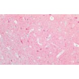 Immunohistochemistry - Anti-PGP9.5 Antibody (A84848) - Antibodies.com