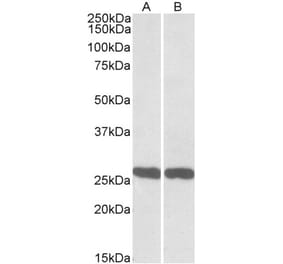 Western Blot - Anti-PGP9.5 Antibody (A84849) - Antibodies.com