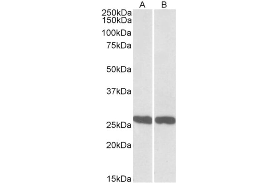 Western Blot - Anti-PGP9.5 Antibody (A84849) - Antibodies.com