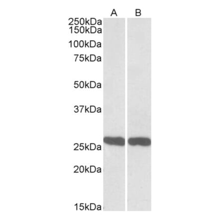 Western Blot - Anti-PGP9.5 Antibody (A84849) - Antibodies.com