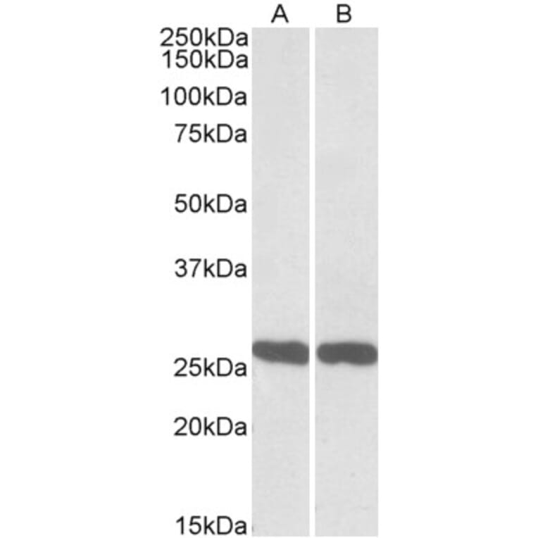 Western Blot - Anti-PGP9.5 Antibody (A84849) - Antibodies.com