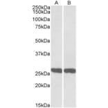 Western Blot - Anti-PGP9.5 Antibody (A84849) - Antibodies.com