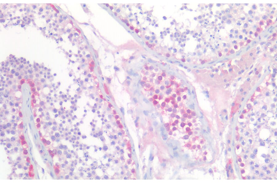 Immunohistochemistry - Anti-PGP9.5 Antibody (A84849) - Antibodies.com