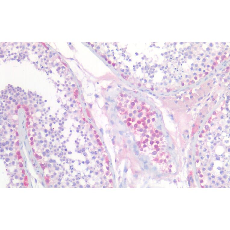 Immunohistochemistry - Anti-PGP9.5 Antibody (A84849) - Antibodies.com