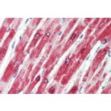 Immunohistochemistry - Anti-Phospholamban Antibody (A84850) - Antibodies.com