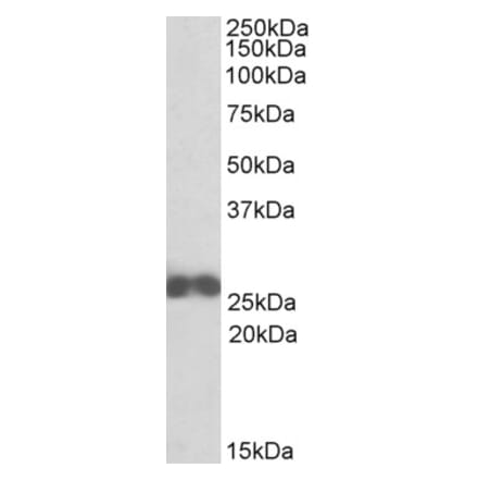 Western Blot - Anti-D4 GDI Antibody (A84851) - Antibodies.com