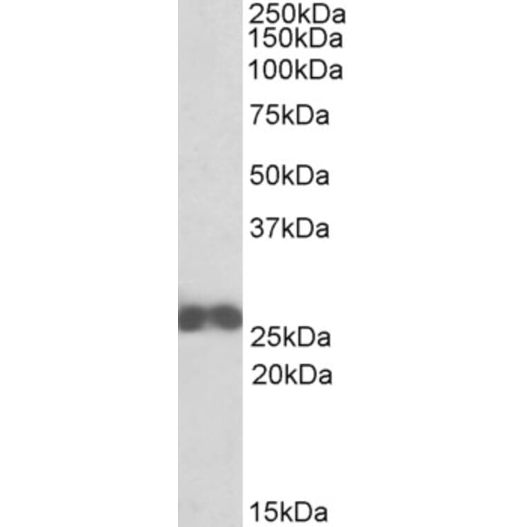 Western Blot - Anti-D4 GDI Antibody (A84851) - Antibodies.com