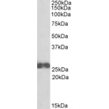 Western Blot - Anti-D4 GDI Antibody (A84851) - Antibodies.com