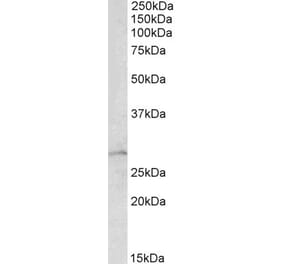 Western Blot - Anti-RhoGDI Antibody (A84852) - Antibodies.com