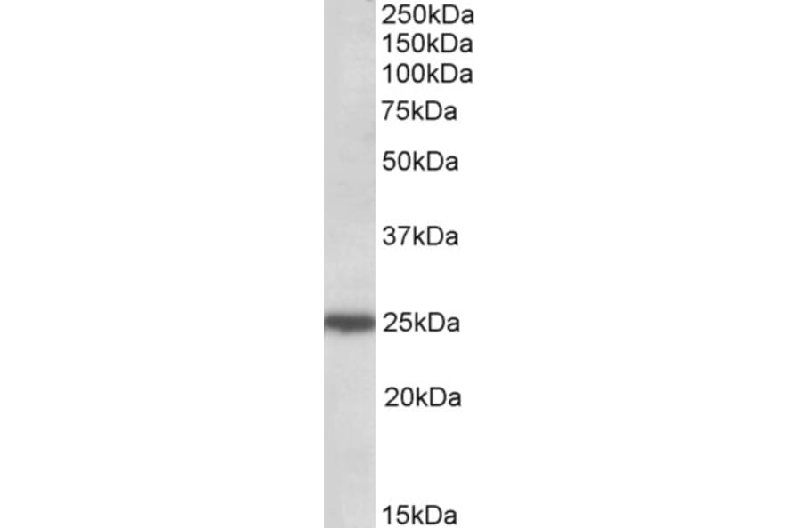 Western Blot - Anti-ARHGDIG Antibody (A84853) - Antibodies.com