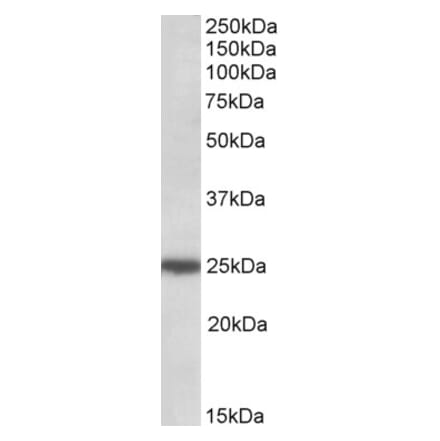 Western Blot - Anti-ARHGDIG Antibody (A84853) - Antibodies.com