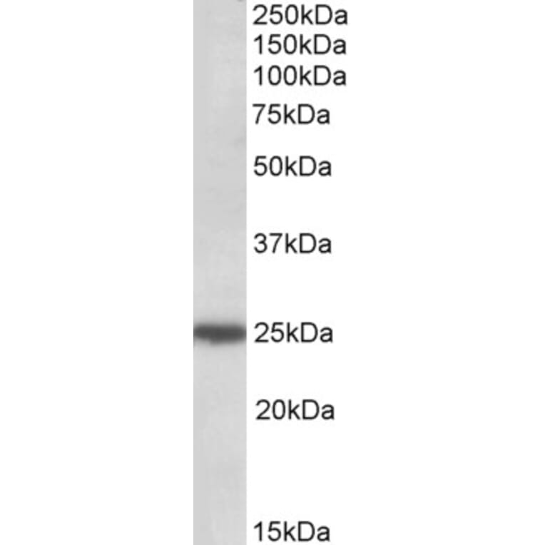 Western Blot - Anti-ARHGDIG Antibody (A84853) - Antibodies.com