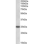Western Blot - Anti-ARHGDIG Antibody (A84853) - Antibodies.com