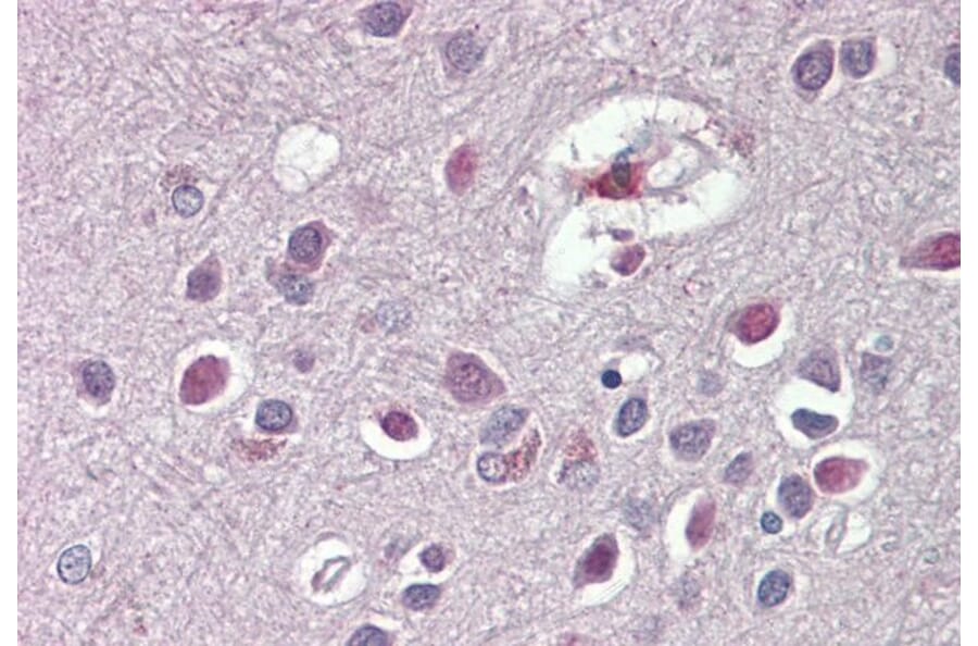 Immunohistochemistry - Anti-ARHGDIG Antibody (A84853) - Antibodies.com