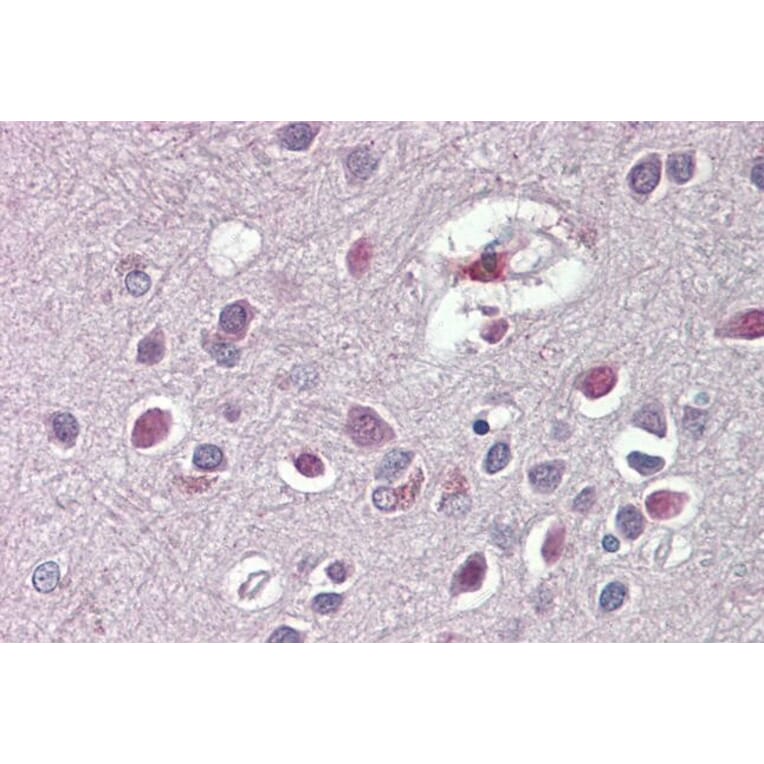 Immunohistochemistry - Anti-ARHGDIG Antibody (A84853) - Antibodies.com