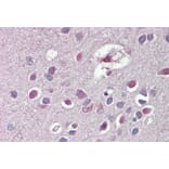 Immunohistochemistry - Anti-ARHGDIG Antibody (A84853) - Antibodies.com