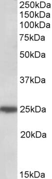 Anti-ARHGDIG Antibody (A84853) (0.5µg/ml) staining of HeLa lysate (35µg protein in RIPA buffer). Primary incubation was 1 hour. Detected by chemiluminescence.
