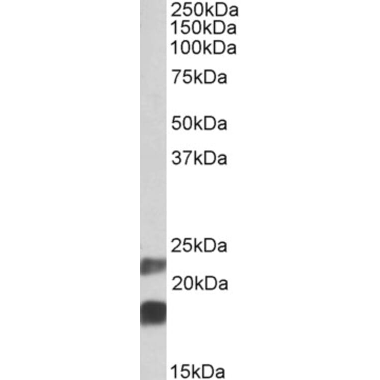Western Blot - Anti-CIRP Antibody (A84854) - Antibodies.com