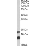 Western Blot - Anti-CIRP Antibody (A84854) - Antibodies.com