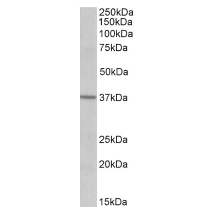 Western Blot - Anti-S1PR2 Antibody (A84856) - Antibodies.com