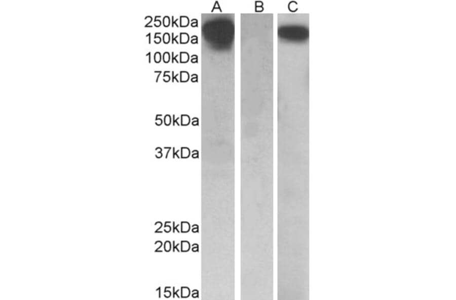 Western Blot - Anti-CSF-1-R Antibody (A84857) - Antibodies.com