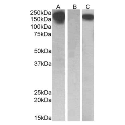 Western Blot - Anti-CSF-1-R Antibody (A84857) - Antibodies.com