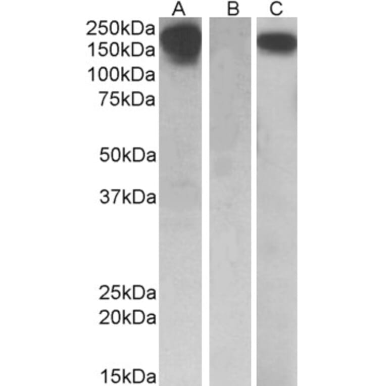 Western Blot - Anti-CSF-1-R Antibody (A84857) - Antibodies.com