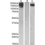 Western Blot - Anti-CSF-1-R Antibody (A84857) - Antibodies.com