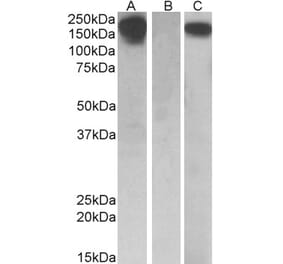 Western Blot - Anti-CSF1R Antibody (A84857) - Antibodies.com