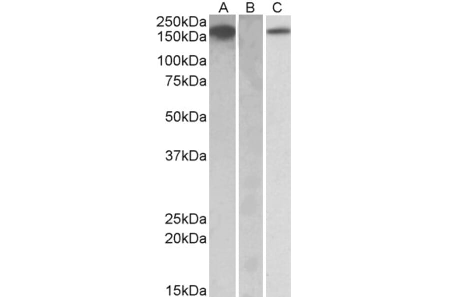 Western Blot - Anti-CSF-1-R Antibody (A84858) - Antibodies.com