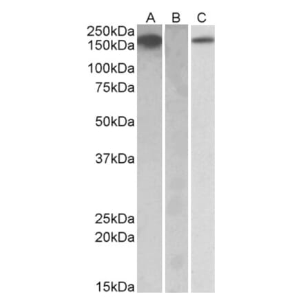Western Blot - Anti-CSF-1-R Antibody (A84858) - Antibodies.com