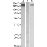 Western Blot - Anti-CSF-1-R Antibody (A84858) - Antibodies.com
