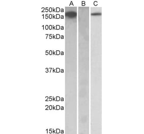 Western Blot - Anti-CSF1R Antibody (A84858) - Antibodies.com