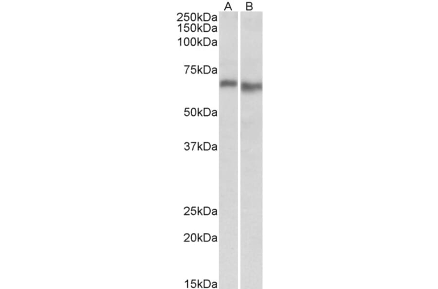 Western Blot - Anti-AMPK alpha 2 Antibody (A84859) - Antibodies.com