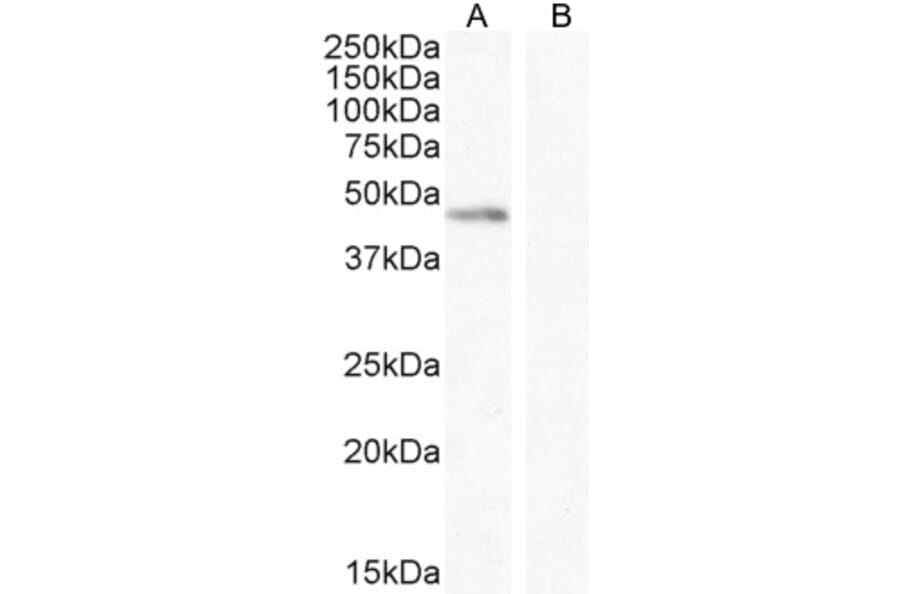 Western Blot - Anti-Angiopoietin 1 Antibody (A84861) - Antibodies.com