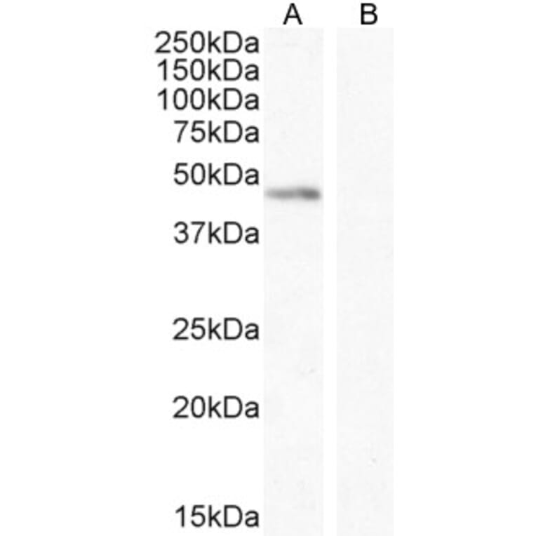 Western Blot - Anti-Angiopoietin 1 Antibody (A84861) - Antibodies.com