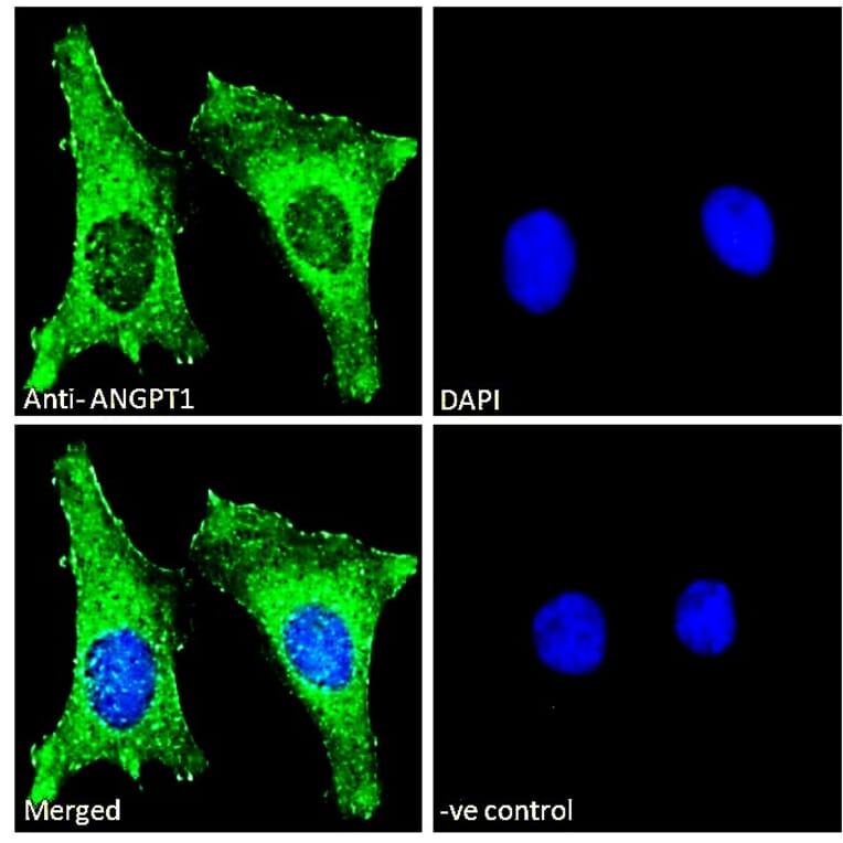 Immunofluorescence - Anti-Angiopoietin 1 Antibody (A84861) - Antibodies.com