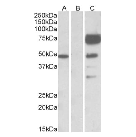 Western Blot - Anti-ANGPT1 Antibody (A84861) - Antibodies.com