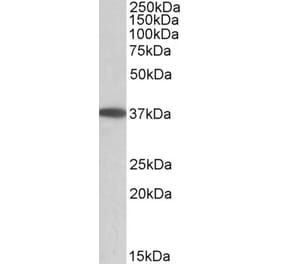 Western Blot - Anti-MGAT2 Antibody (A84863) - Antibodies.com