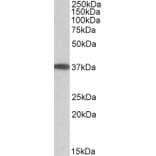Western Blot - Anti-MGAT2 Antibody (A84863) - Antibodies.com