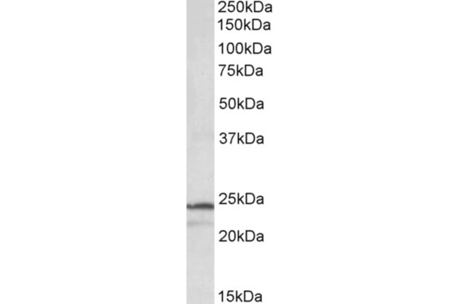 Western Blot - Anti-PSMB3 Antibody (A84864) - Antibodies.com