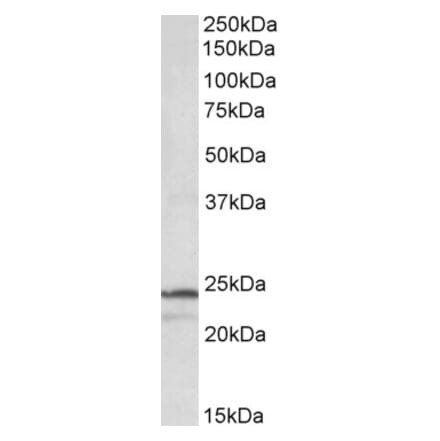 Western Blot - Anti-PSMB3 Antibody (A84864) - Antibodies.com