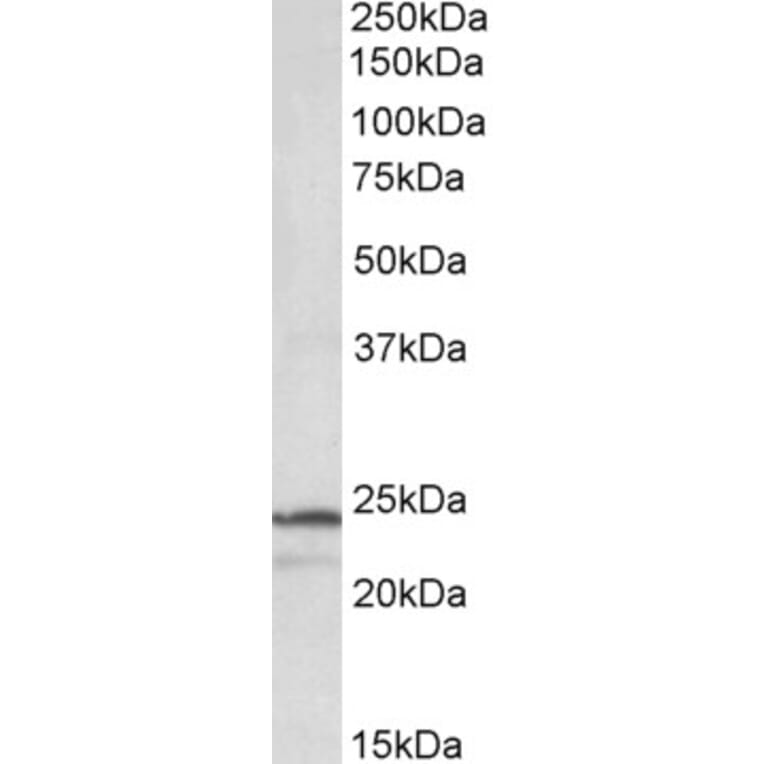 Western Blot - Anti-PSMB3 Antibody (A84864) - Antibodies.com